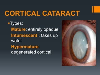 COMMON OPD.pptx