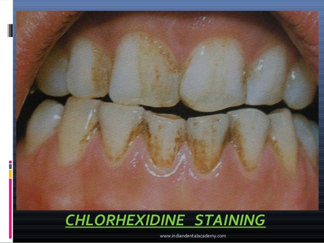 Common oral diseases / dental implant courses