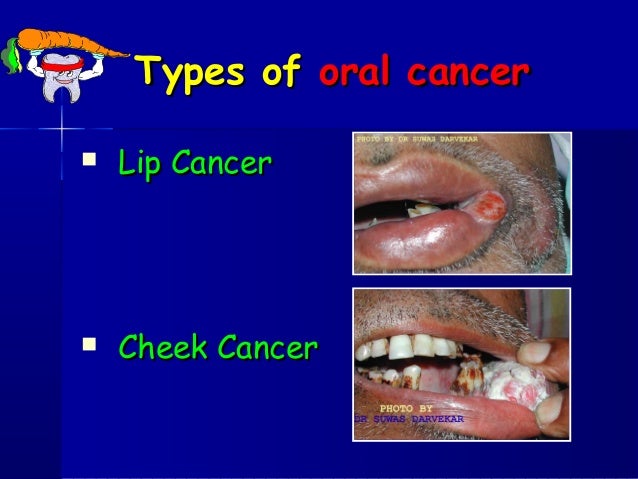 health problem common oral health oral problems Common health problem common oral health oral problems Common