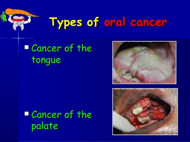 common health oral problem problems Common oral health common health oral problem problems Common oral health
