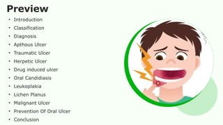 Common Oral Ulcer And Their Management By Stuti and Jasmin.pptx