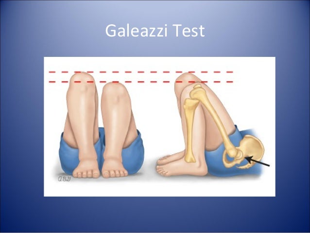 Common orthopedic problems