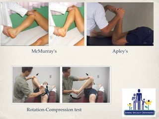 McMurray's                Apley's




Rotation-Compression test
 