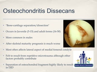 Osteochondritis Dissecans

✤   "Bone-cartilage separation/dissection"

✤   Occurs in Juvenile (5-15) and adult forms (16-50)

✤   More common in males

✤   After skeletal maturity prognosis is much worse

✤   Most often affects lateral aspect of medial femoral condyle

✤   Felt to result from repetitive microtrauma although other
    factors probably contribute

✤   Separation of osteochondral fragment highly likely to result
    in DJD
 