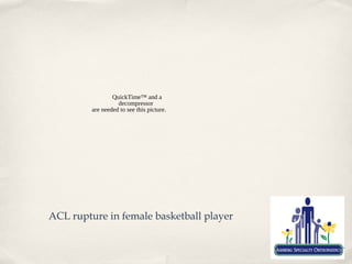 QuickTime™ and a
                   decompressor
         are needed to see this picture.




ACL rupture in female basketball player
 