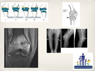 Salter-Harris classification
 