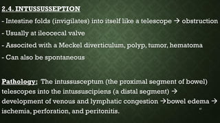 Common paediatric surgical conditions | PDF