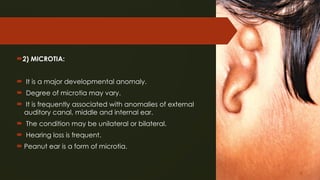 Microcus Ear COMMON PATHOLOGIES IN THE EAR (1).pptx