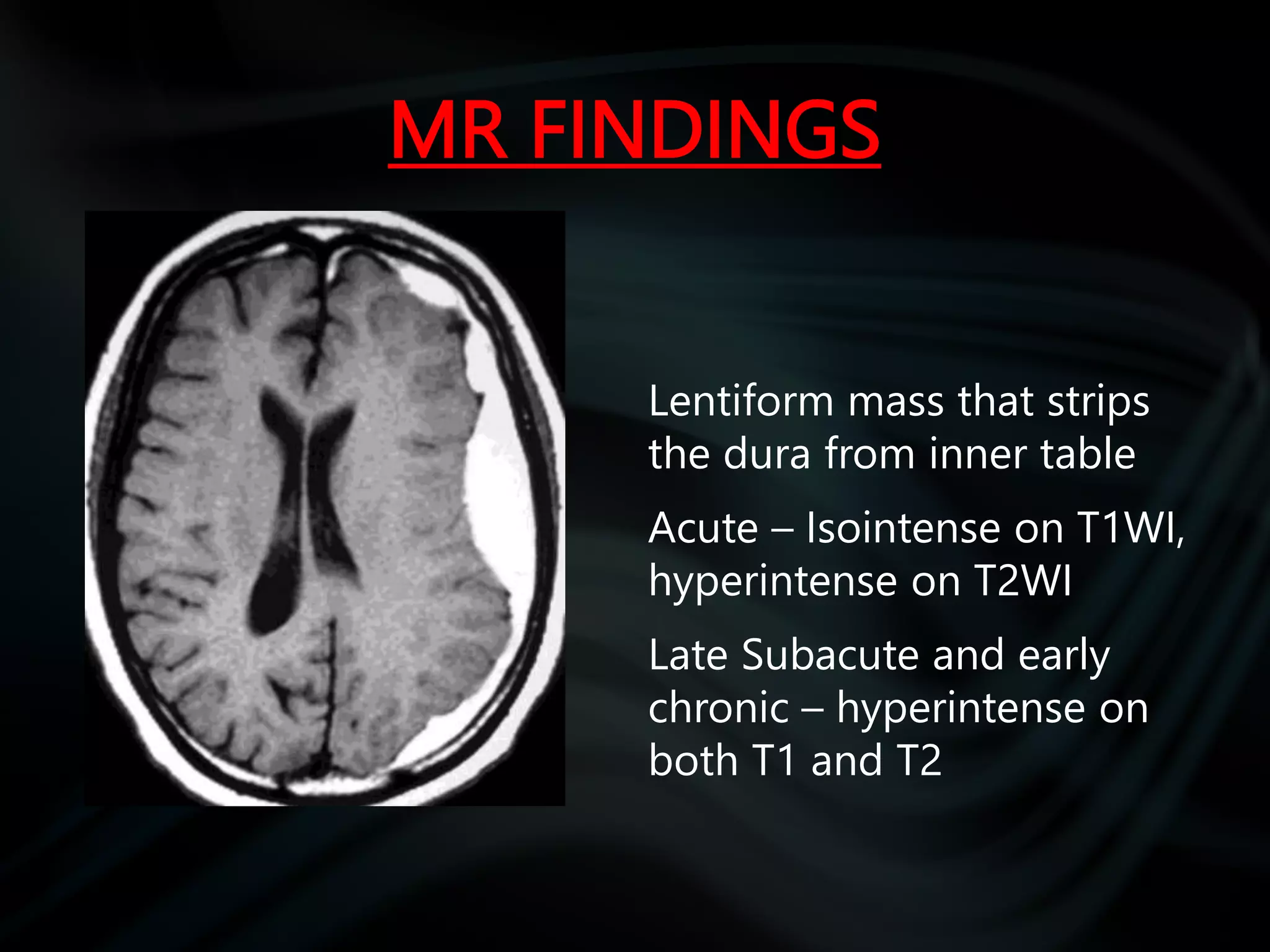 common pathologies of brain.pptx