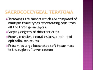  Teratomas are tumors which are composed of
multiple tissue types representing cells from
all the three germ layers.
 Varying degrees of differentiation
 Bones, muscles, neural tissues, teeth, and
epithelial structures
 Present as large bosselated soft tissue mass
in the region of lower sacrum
 