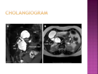 Common pediatric surgical problems