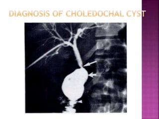 Common pediatric surgical problems