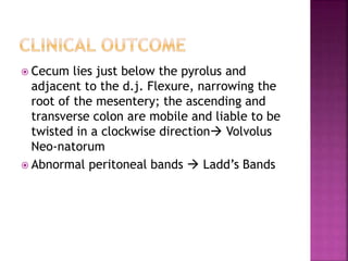  Cecum lies just below the pyrolus and
adjacent to the d.j. Flexure, narrowing the
root of the mesentery; the ascending and
transverse colon are mobile and liable to be
twisted in a clockwise direction Volvolus
Neo-natorum
 Abnormal peritoneal bands  Ladd’s Bands
 