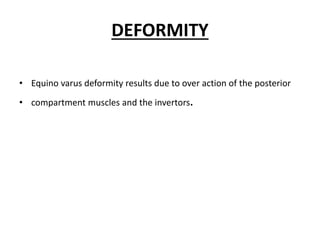DEFORMITY
• Equino varus deformity results due to over action of the posterior
• compartment muscles and the invertors.
 