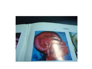 Common problems in paediatric surgery.pptx