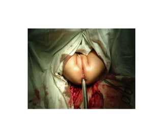 Common problems in paediatric surgery.pptx