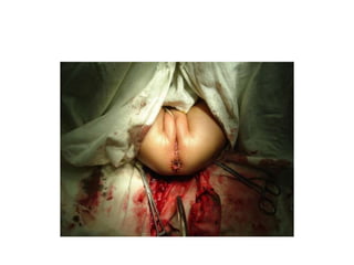 Common problems in paediatric surgery.pptx