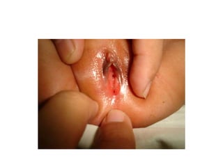 Common problems in paediatric surgery.pptx