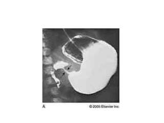 Common problems in paediatric surgery.pptx