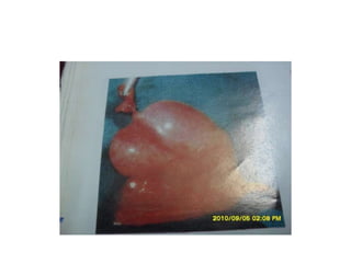 Common problems in paediatric surgery.pptx