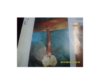 Common problems in paediatric surgery.pptx
