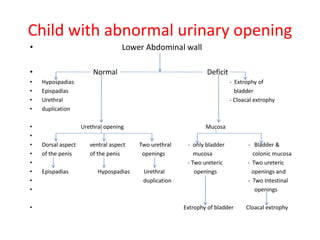 Child with abnormal urinary opening
• Lower Abdominal wall
• Normal Deficit
• Hypospadias - Extrophy of
• Epispadias bladder
• Urethral - Cloacal extrophy
• duplication
• Urethral opening Mucosa
•
• Dorsal aspect ventral aspect Two urethral - only bladder - Bladder &
• of the penis of the penis openings mucosa colonic mucosa
• - Two ureteric - Two ureteric
• Epispadias Hypospadias Urethral openings openings and
• duplication - Two Intestinal
• openings
• Extrophy of bladder Cloacal extrophy
 