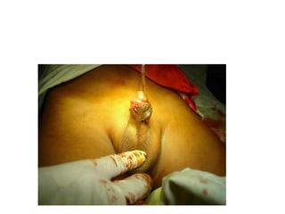 Common problems in paediatric surgery.pptx