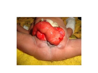 Common problems in paediatric surgery.pptx