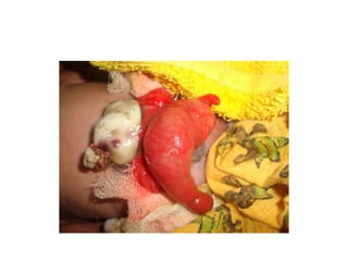 Common problems in paediatric surgery.pptx