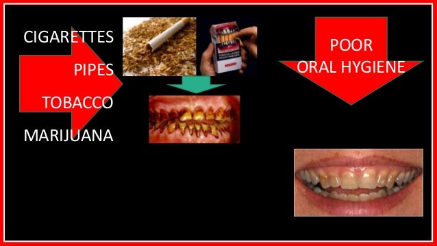 problem oral cavity definition problems of cavity Common oral problem oral cavity definition problems of cavity Common oral