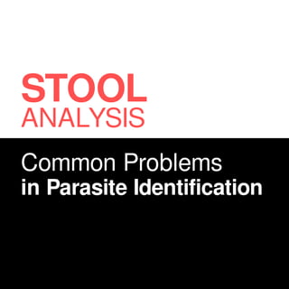Common Problems
in Parasite Identification
STOOL
ANALYSIS
 
