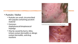 Common Rash in Children - prepared for CME Paeds.pptx