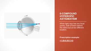 Overview of Common Refractive Errors in the Human Eye | PDF