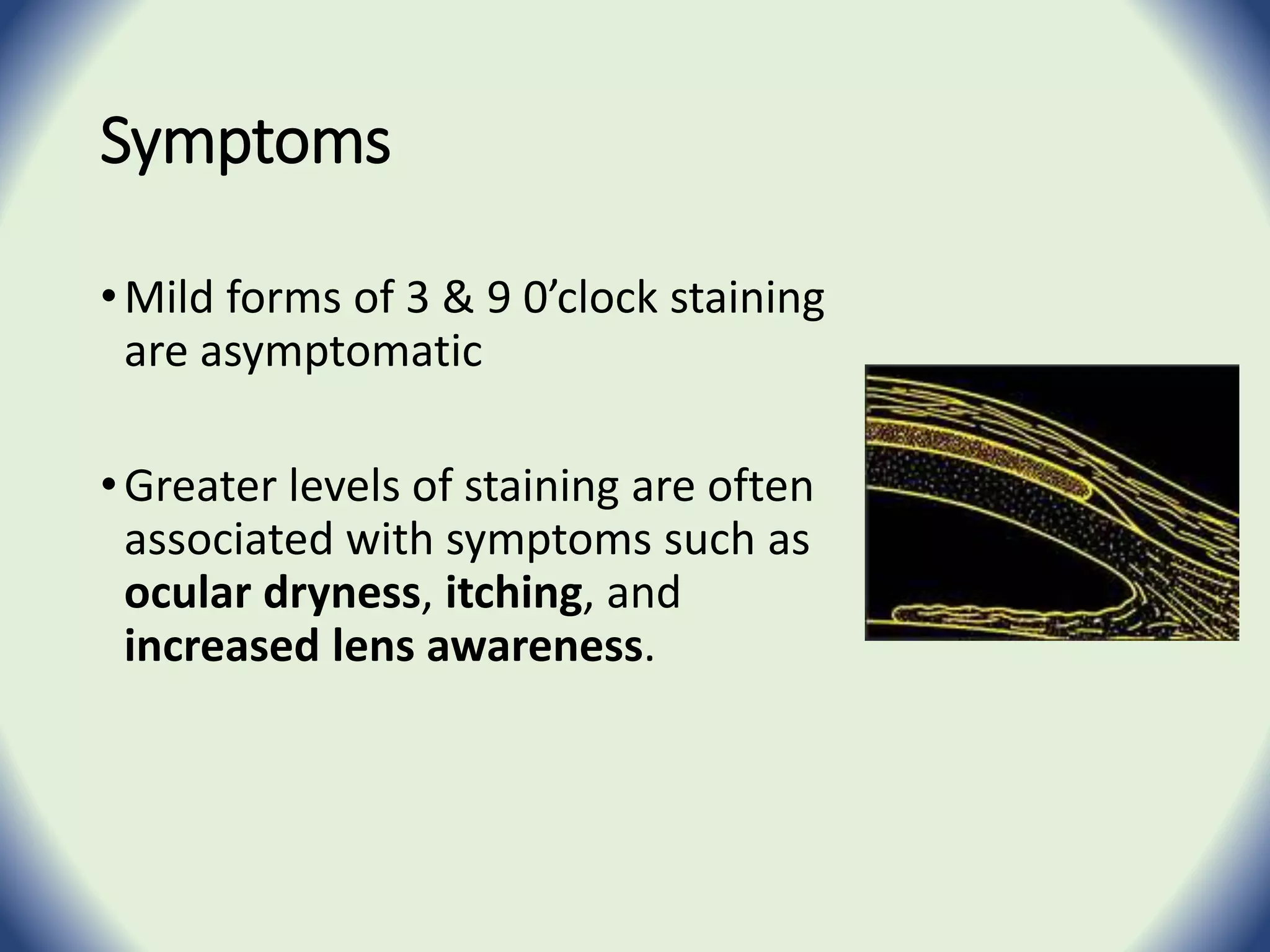 RGP Complications | PPTX
