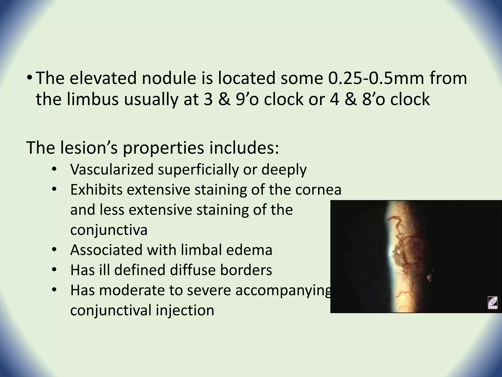 RGP Complications | PPTX | Eye and Vision Conditions | Diseases and ...