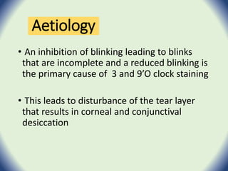 • An inhibition of blinking leading to blinks
that are incomplete and a reduced blinking is
the primary cause of 3 and 9’O clock staining
• This leads to disturbance of the tear layer
that results in corneal and conjunctival
desiccation
Aetiology
 