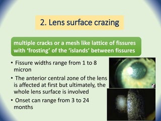 2. Lens surface crazing
• Fissure widths range from 1 to 8
micron
• The anterior central zone of the lens
is affected at first but ultimately, the
whole lens surface is involved
• Onset can range from 3 to 24
months
multiple cracks or a mesh like lattice of fissures
with ‘frosting’ of the ‘islands’ between fissures
 