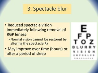 3. Spectacle blur
• Reduced spectacle vision
immediately following removal of
RGP lenses
•Normal vision cannot be restored by
altering the spectacle Rx
• May improve over time (hours) or
after a period of sleep
 
