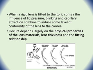 •When a rigid lens is fitted to the toric cornea the
influence of lid pressure, blinking and capillary
attraction combine to induce some level of
conformity of the lens to the cornea
•Flexure depends largely on the physical properties
of the lens materials, lens thickness and the fitting
relationship
 