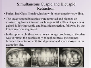 Common Sense Mechanics in Orthodontics: Principles and Applications | PPTX