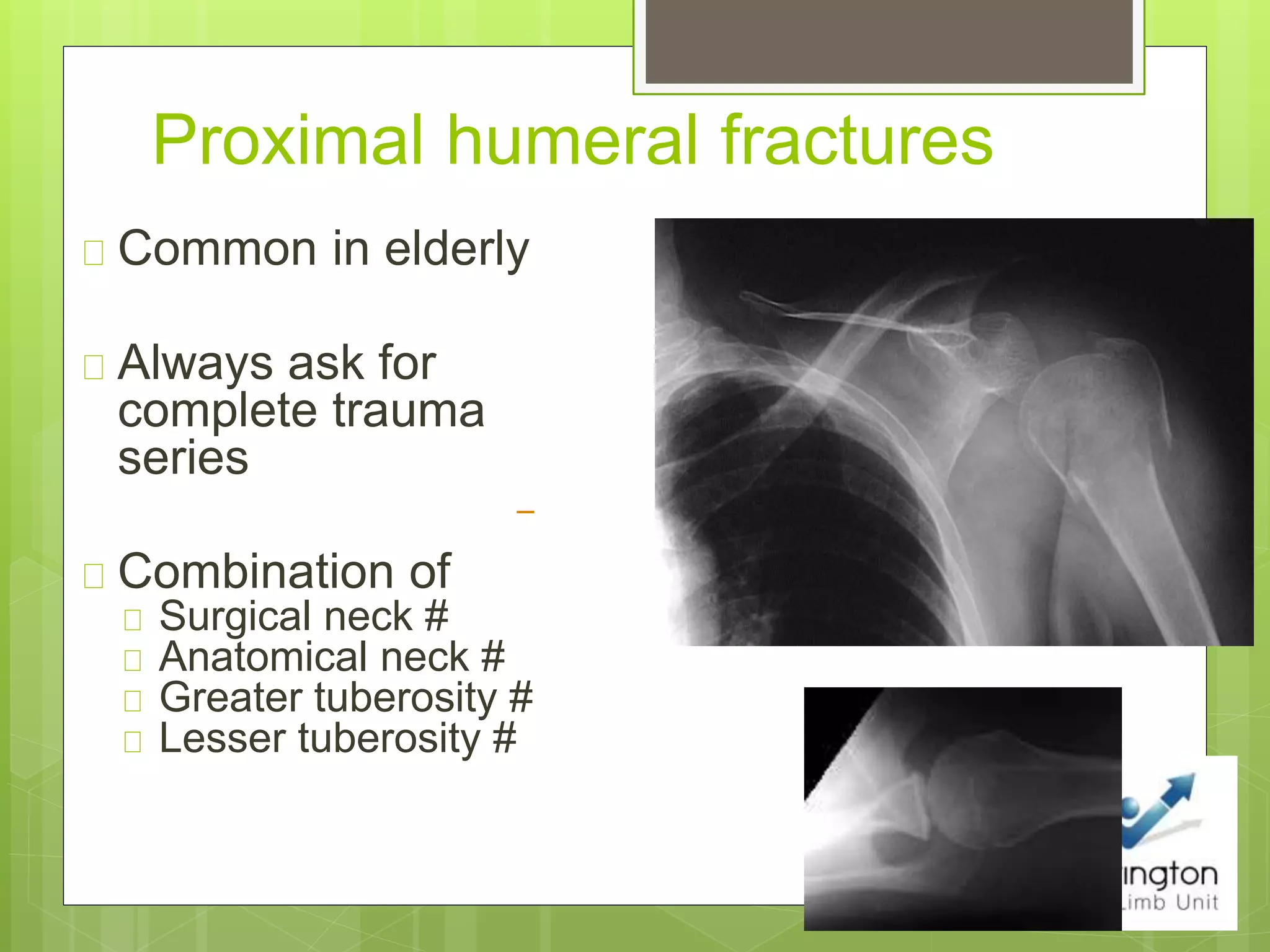 Proximal humeral fractures
Common in elderly
Always ask for
complete trauma
series
Combination of
Surgical neck #
Anatomical neck #
Greater tuberosity #
Lesser tuberosity #
 