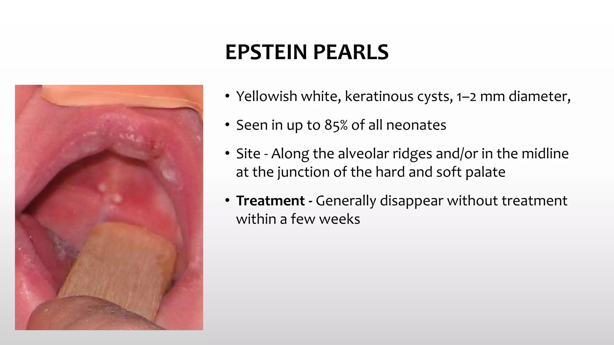 Common Skin Conditions In Neonates PPTX