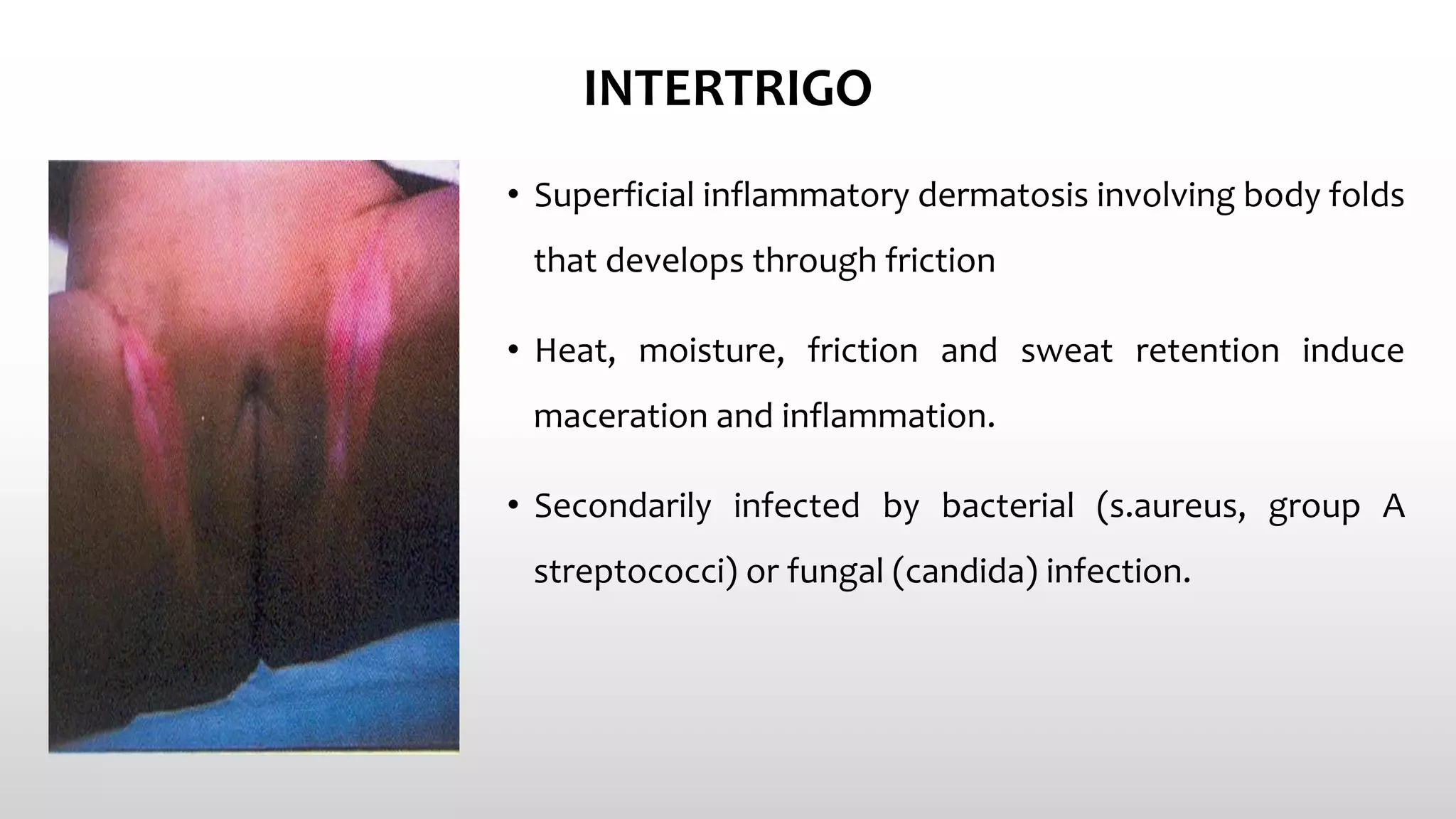 Common Skin Conditions In Neonates PPTX