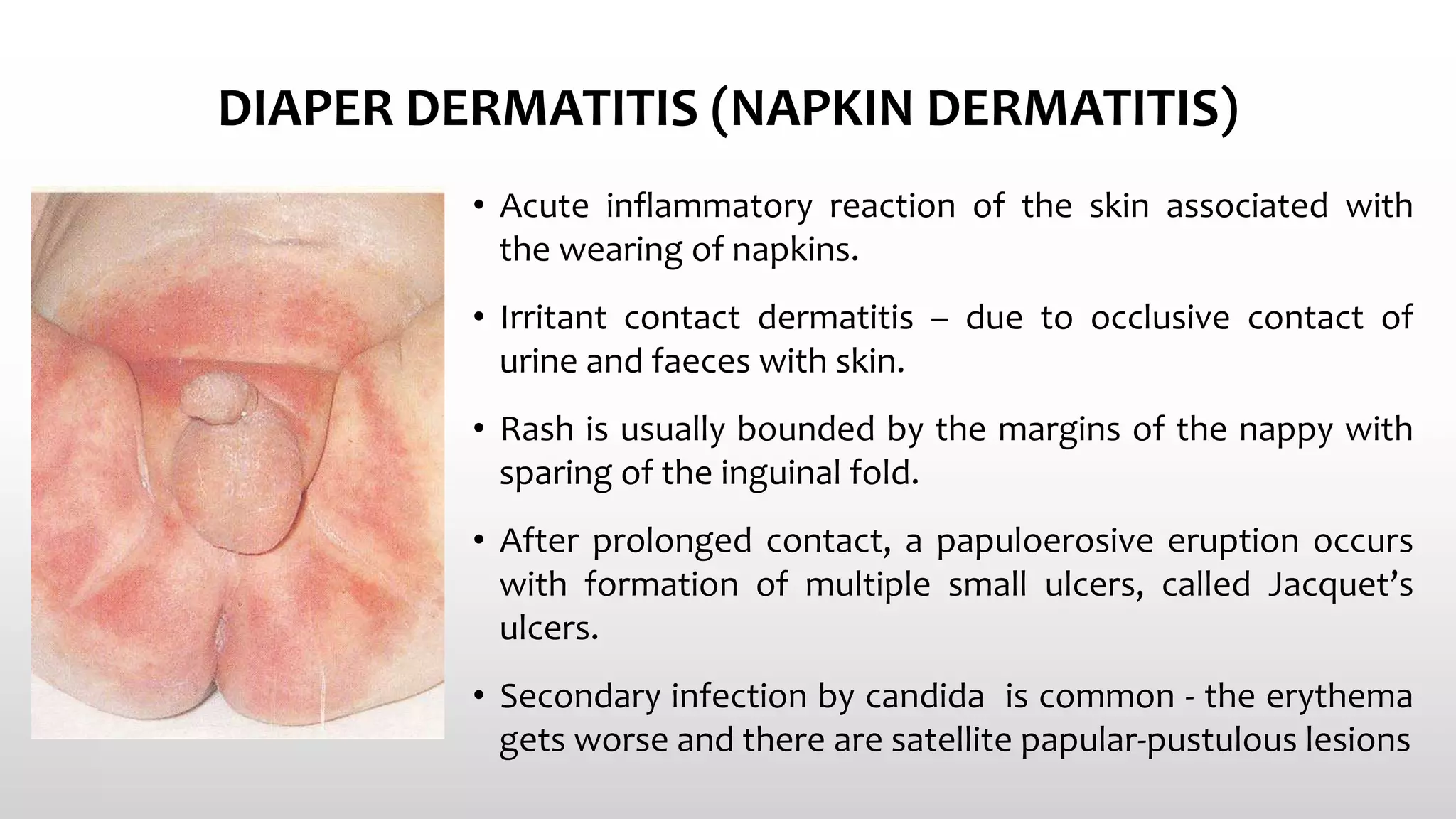 Common skin conditions in neonates | PPTX