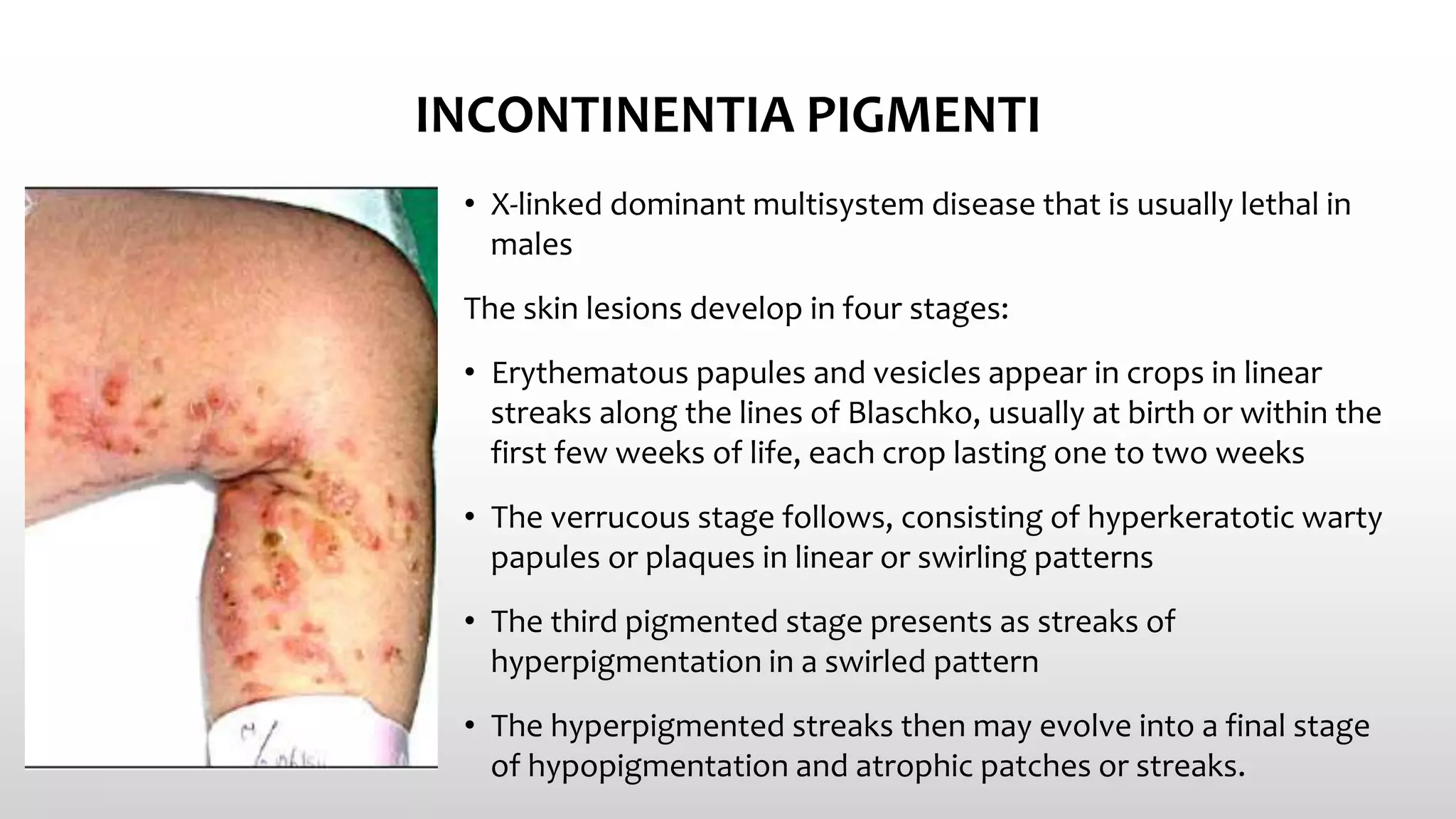 Common Skin Conditions In Neonates PPTX
