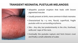 TRANSIENT NEONATAL PUSTULAR MELANOSIS
• Idiopathic pustular eruption that heals with brown
pigmented macules
• Usually present at birth, more common in black neonates
• Characterized by 1–3 mm, flaccid, superficial, fragile
pustules with no surrounding erythema
• Site – Any site, but predominantly in the chin, forehead,
axilla and nape of the neck.
• Eventually the pustules rupture and form brown crust
and finally a small collarette of scales
 