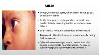 MILIA
• Benign, keratinous cysts, which affect about 40-50%
of newborn babies
• Small, firm, pearly- white papules, 1-2 mm in size
predominantly occurring on the face of newborn
babies
• Site - cheeks, nose, nasolabial fold and forehead
• Treatment - Usually disappear spontaneously during
first 3-4 weeks.
• D/D molluscum contageosum – does not usually
appear in immediate neonatal period, Sebaceous
gland hyperplasia-yellow rather than whitish
 