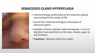 SEBACEOUS GLAND HYPERPLASIA
• Common benign proliferation of the sebaceous glands
seen during the first weeks of life
• Result from maternal androgenic stimulation of
sebaceous gland
• Multiple, uniform, pinpoint, yellowish papules 1–3 mm in
diameter most prominent on the nose, cheeks, upper lip
and forehead
• Treatment - Resolves within few weeks
 