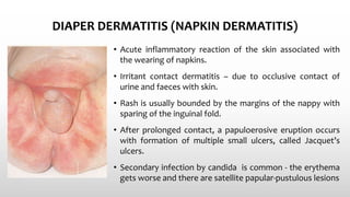 DIAPER DERMATITIS (NAPKIN DERMATITIS)
• Acute inflammatory reaction of the skin associated with
the wearing of napkins.
• Irritant contact dermatitis – due to occlusive contact of
urine and faeces with skin.
• Rash is usually bounded by the margins of the nappy with
sparing of the inguinal fold.
• After prolonged contact, a papuloerosive eruption occurs
with formation of multiple small ulcers, called Jacquet’s
ulcers.
• Secondary infection by candida is common - the erythema
gets worse and there are satellite papular-pustulous lesions
 