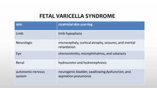FETAL VARICELLA SYNDROME
 
